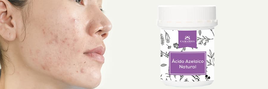 ácido azelaico para problemas dermatológicos